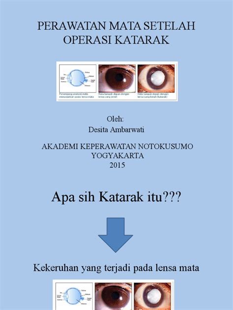 PDF Lembar Balik Perawatan Mata Post Op Katarak DOKUMEN TIPS