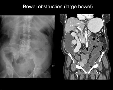 On Call Radiology Common Radiology Findings On Call And In The