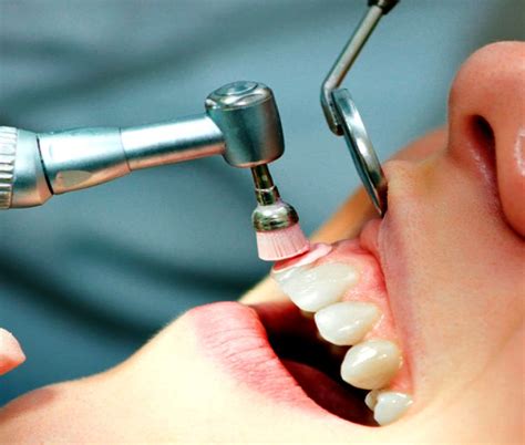 Que Es La Profilaxis Dental Y Cual Es Su Importancia Neodentis Blog