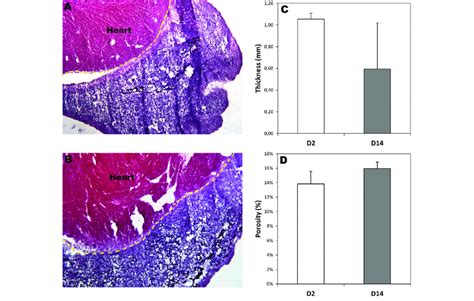 Biocompatibility Of The Electrospun Collagen Scaffold Hearts Of