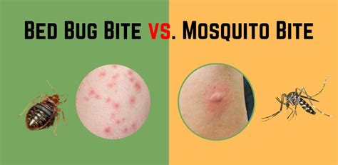 Bed Bug Bite Vs Mosquito Bite Bugs In The Bed