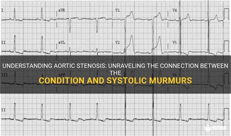 Understanding Aortic Stenosis: Unraveling The Connection Between The ...