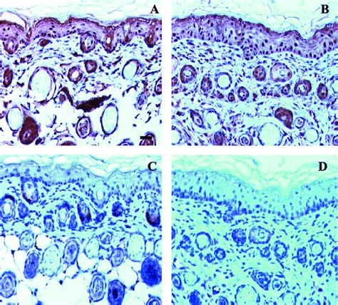 CMK Dependent Inhibition Of TPA Induced Epidermal Proliferation The