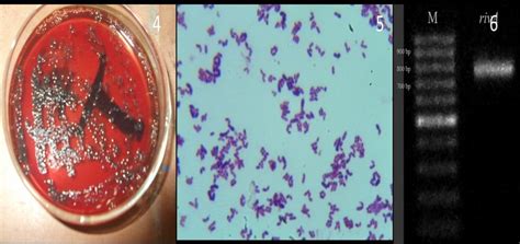 D Nicolas Floyd Listeria Monocytogenes Gram Stain Color