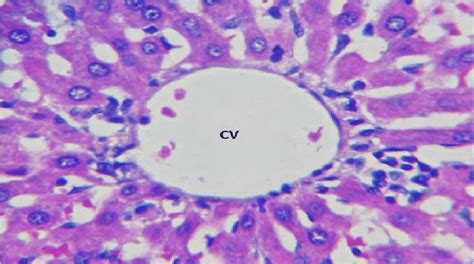 The Photomicrograph Sections Of The Liver From Wistar Rats Treated