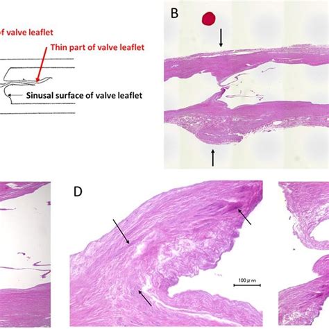 Internal Mammary Vein Imv Samples A A Red Line Shows The Area Of