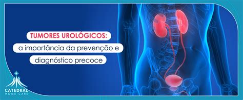 Tumores Urológicos a importância da prevenção e diagnóstico precoce