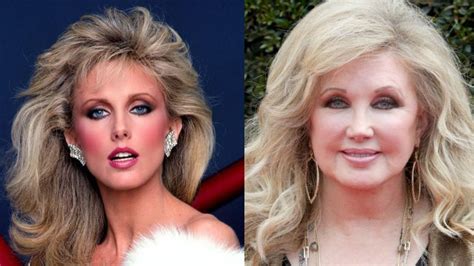 Morgan Fairchilds Plastic Surgery Is Helping Her Appear Young And