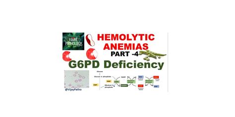 Pathology Of G6pd Deficiency Pathology Made Simple