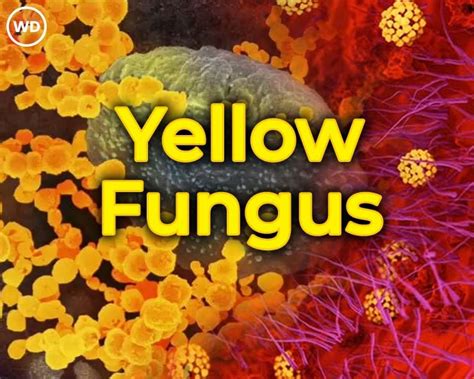 Yellow fungus - Symptoms, Causes, Prevention & Treatment - Santripty