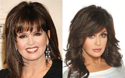 Marie Osmond before and after plastic surgery | Celebrity plastic ...