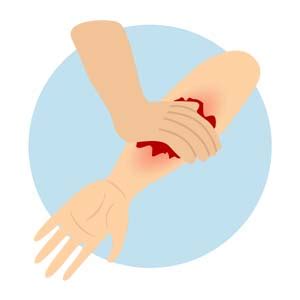 When Does Bleeding Need Emergency Care?