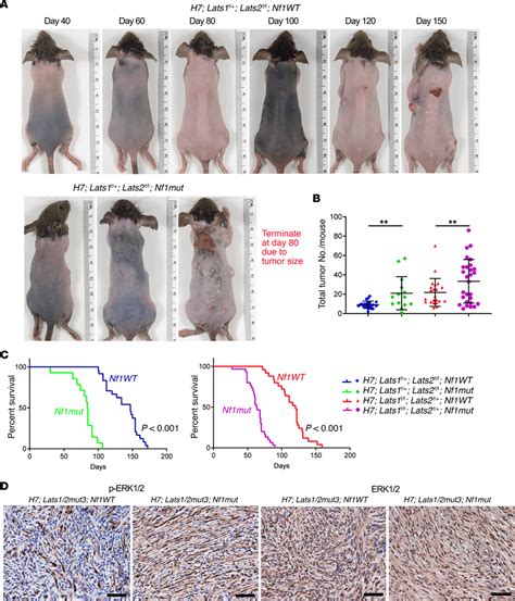 The Mapk Pathway Is A Modifier Of Schwannomagenesis A Representative