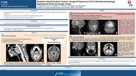 Pediatric Head And Neck Tumors Surgical Experience Of An