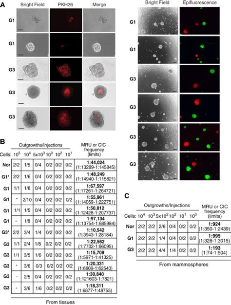 Biological And Molecular Heterogeneity Of Breast Cancers Correlates