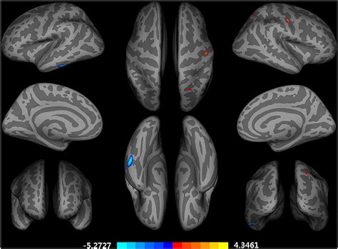 Frontiers Differential Impact Of Education On Gray Matter Volume