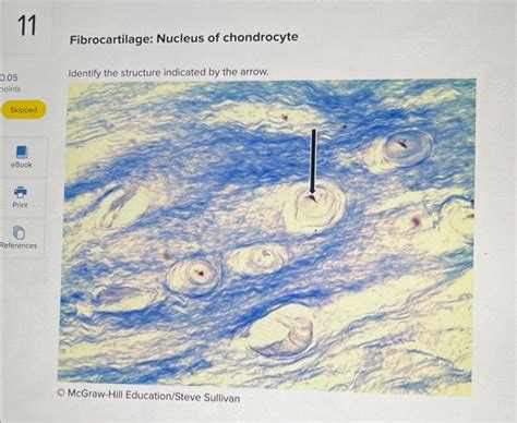 Solved Fibrocartilage Nucleus Of Chondrocyte Identifu The