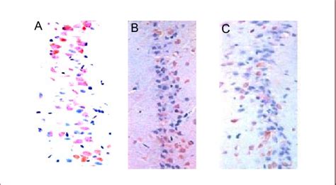 Expression of Bcl-2 in the rat hippocampal CA1 region... | Download ... 
