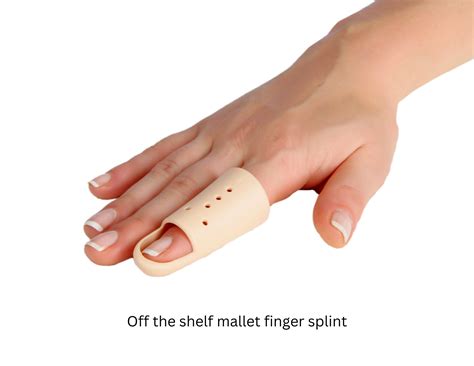 Mallet Finger Perfect Therapy