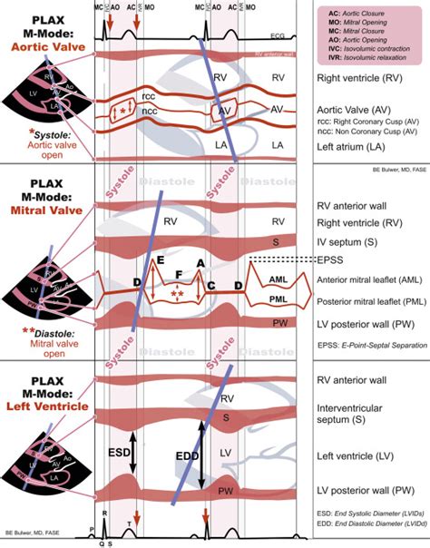 M Mode Imaging Thoracic Key