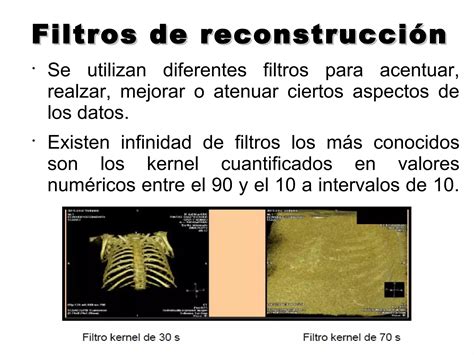 Reconstrucci N En Tc Ppt