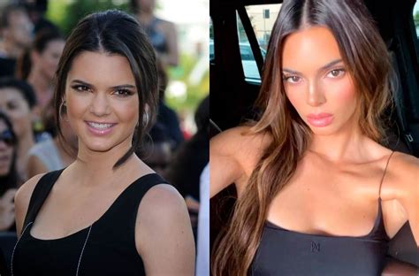 Transformacija Kendall Jenner Koliko Se Popravila Tijekom Godina Story