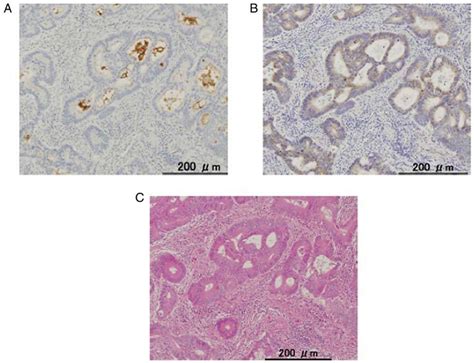 Immunohistochemical Detection Of Leucine Rich Repeat Containing G