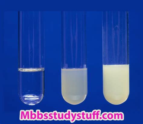 Heat Coagulation test for protein - Medical Study Zone