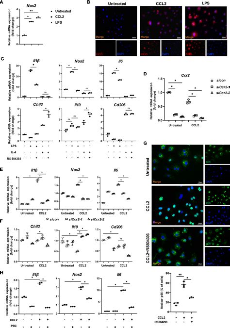 Frontiers Ccr2 Macrophages Promote Orthodontic Tooth Movement And Alveolar Bone Remodeling