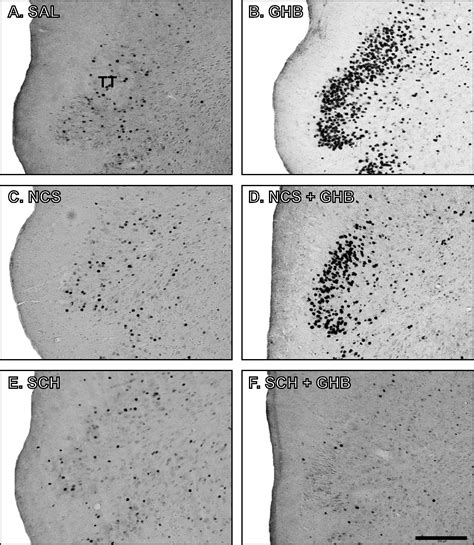 Regional Fos-expression induced by γ-hydroxybutyrate (GHB): Comparison ...