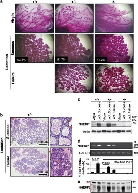 Impaired Mammary Gland Development Correlates With Lack Of NHERF1