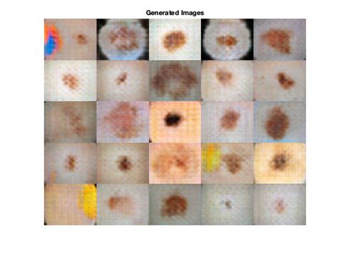 Synthetic Skin Lesion Image Generation Using Gans File Exchange