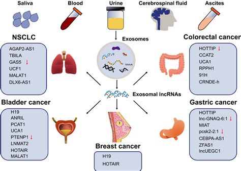 The Clinical Application Of Exosomal Lncrnas In Cancer Exosomal