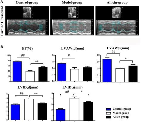 Allicin Improved Cardiac Function In Mice After Myocardial IR Injury