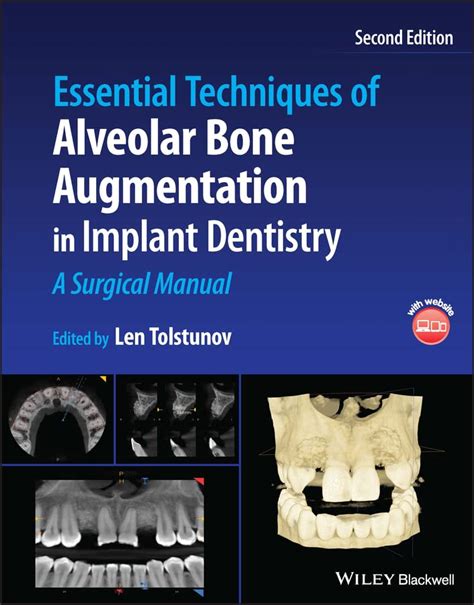 Essential Techniques Of Alveolar Bone Augmentation In