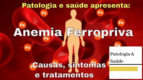 Anemia Ferropriva Causas Sintomas E Tratamentos YouTube