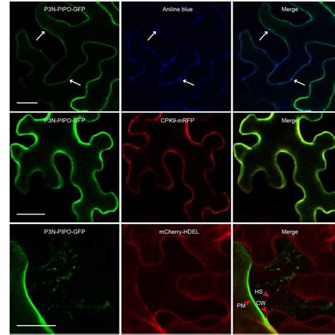 Subcellular Localization Of Truncated Variants Of P N Pipo In N