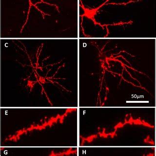 Dendritic spines on medium spiny neurons in the nucleus accumbens ... 