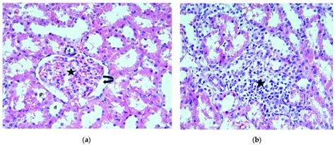 (a) Normal-looking glomeruli (star), macula densa (arrowhead), Bowman's... | Download Scientific ...