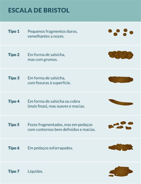 Voc Domina O Manejo Da Constipa O Intestinal