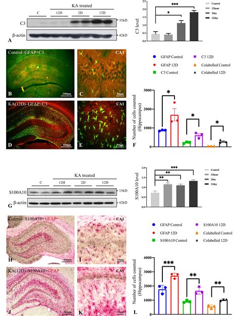 Administration Of Kainic Acid Differentially Alters Astrocyte Markers