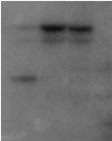(A) Schematic diagram (not to scale) indicating the exon–intron ...