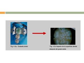 Odontolog A Preventiva Del Ni O Y Adolescente Ii Ppt