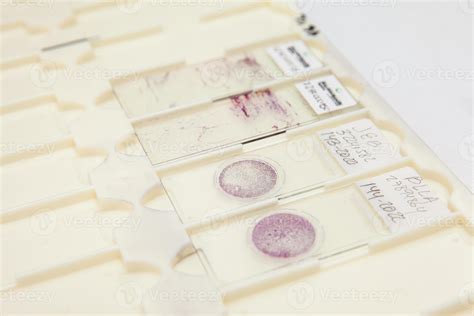 Traditional And Liquid Based Cytology Microscope Slides For Pap Smear