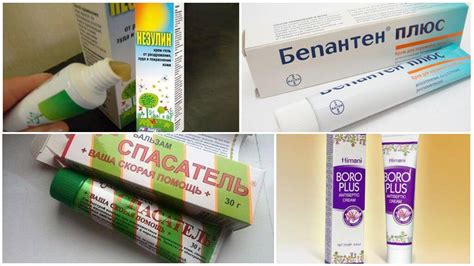 Средство от укусов комаров: мазь, гель, народные методы - чем лучше ...