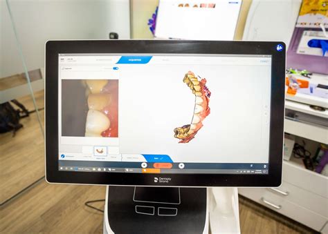 Why Are My Gums Bleeding? - Sunbury Dental House