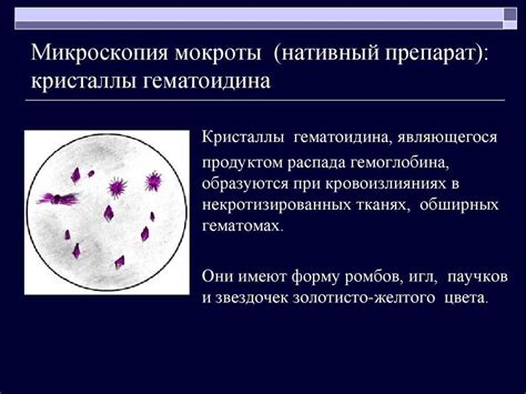 Мокрота Картинки С Описанием – Telegraph