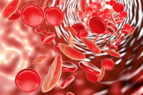 Anemia por falta o deficiencia de hierro anemia ferropénica causas y