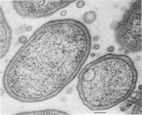 3: Ultrastructure of P. gingivalis. An electron microscopy micrograph ... 