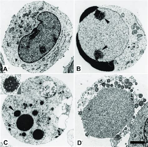 Transmission Electron Microscopic Appearance Of K562 Cells 10 A Download Scientific Diagram